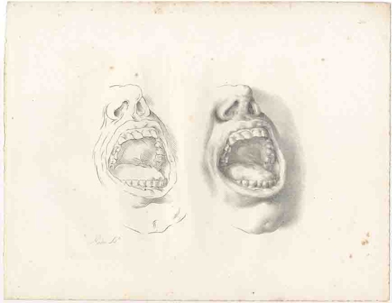 11052 G_Vicent Rodes_